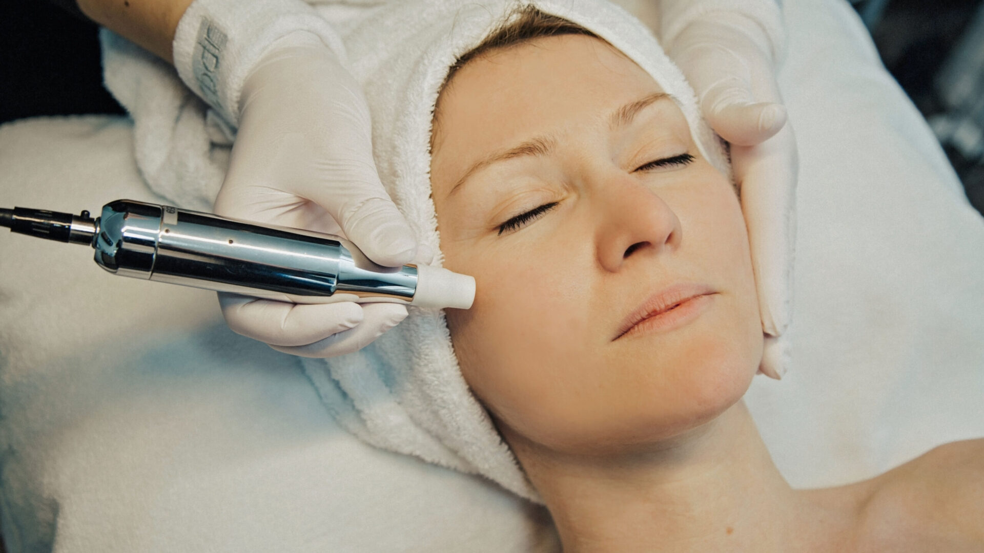 BDR Softneedling im Wangenbereich während einer Gesichtsbehandlung im Hautstudio Amy in Ravensburg