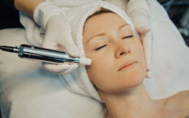 BDR Softneedling im Wangenbereich während einer Gesichtsbehandlung im Hautstudio Amy in Ravensburg