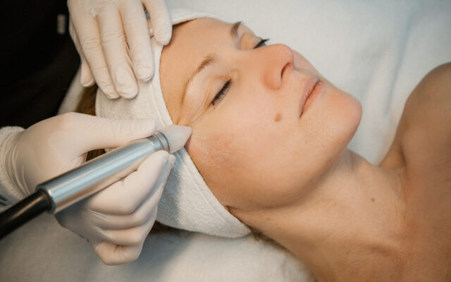 Microdermabrasion im Hautstudio Amy in Ravensburg während einer professionellen Gesichtsbehandlung