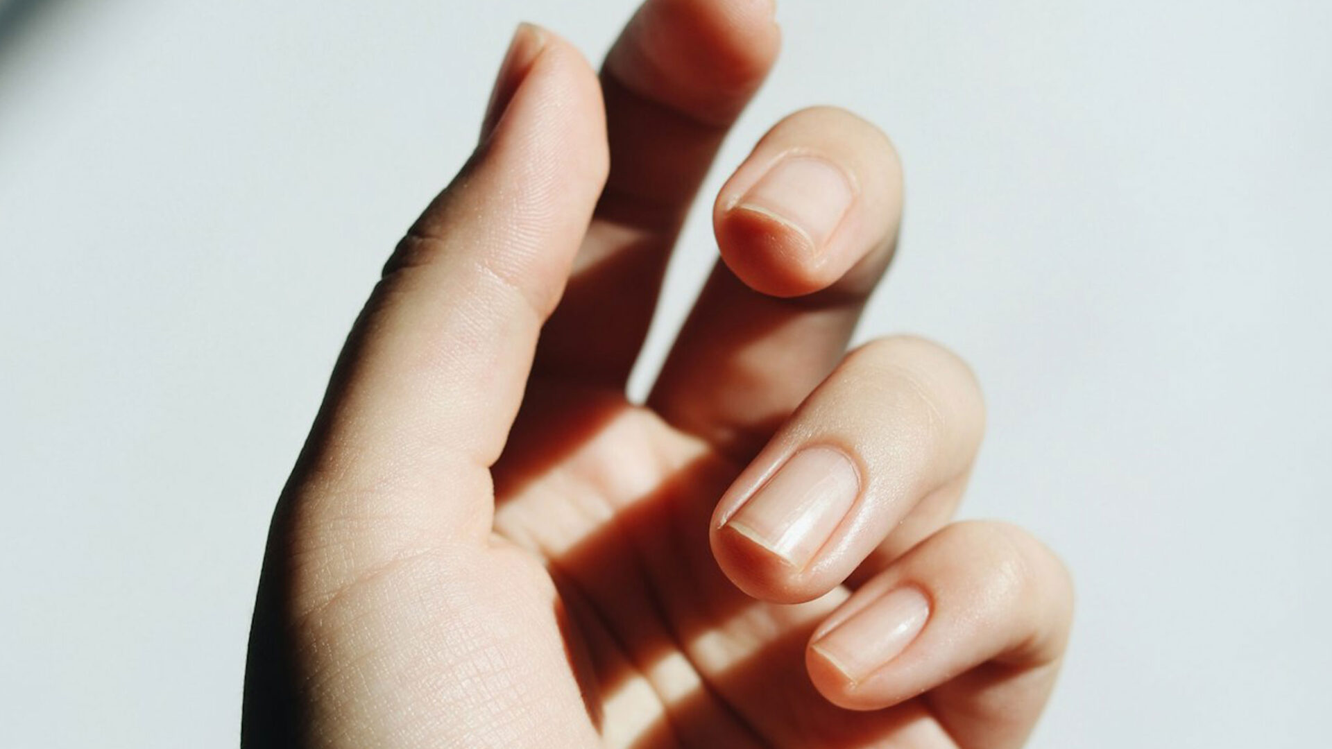 Natürliche Fingernägel nach dem professionellen Ablösen von Shellac