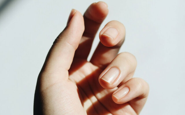 Natürliche Fingernägel nach dem professionellen Ablösen von Shellac